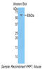 Perforin 1 antibody, LS-C298899, Lifespan Biosciences, Western Blot image 