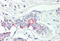 TNF Alpha Induced Protein 8 antibody, MBS247439, MyBioSource, Immunohistochemistry frozen image 