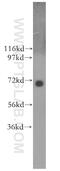 NUAK Family Kinase 2 antibody, 11592-1-AP, Proteintech Group, Western Blot image 