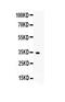 Insulin Like Growth Factor Binding Protein 5 antibody, PA5-79453, Invitrogen Antibodies, Western Blot image 