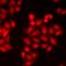 Protein Tyrosine Kinase 6 antibody, LS-C668173, Lifespan Biosciences, Immunofluorescence image 