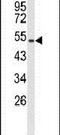 MutY DNA Glycosylase antibody, PA5-26167, Invitrogen Antibodies, Western Blot image 