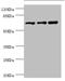 RNA Guanylyltransferase And 5'-Phosphatase antibody, LS-C676413, Lifespan Biosciences, Western Blot image 