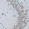 Protein Tyrosine Phosphatase Non-Receptor Type 1 antibody, LS-C331565, Lifespan Biosciences, Immunohistochemistry paraffin image 