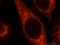 SEC24 Homolog A, COPII Coat Complex Component antibody, 15958-1-AP, Proteintech Group, Immunofluorescence image 