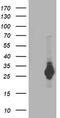 Proteasome Subunit Beta 4 antibody, M05105, Boster Biological Technology, Western Blot image 