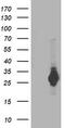 Proteasome Subunit Beta 4 antibody, M05105, Boster Biological Technology, Western Blot image 