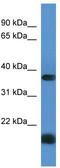 Rhomboid Domain Containing 1 antibody, TA342970, Origene, Western Blot image 