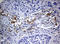 Tyrosinase antibody, LS-C175600, Lifespan Biosciences, Immunohistochemistry paraffin image 