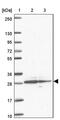 ER Membrane Protein Complex Subunit 10 antibody, PA5-62869, Invitrogen Antibodies, Western Blot image 