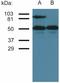 ICAM1 antibody, M00171-2, Boster Biological Technology, Western Blot image 