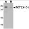 Tctex1 Domain Containing 1 antibody, orb137341, Biorbyt, Western Blot image 