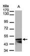 Keratin 14 antibody, PA5-28002, Invitrogen Antibodies, Western Blot image 