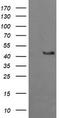 Gamma-Butyrobetaine Hydroxylase 1 antibody, LS-C337964, Lifespan Biosciences, Western Blot image 