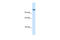 Cullin Associated And Neddylation Dissociated 1 antibody, 28-135, ProSci, Enzyme Linked Immunosorbent Assay image 