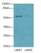 Solute Carrier Family 46 Member 3 antibody, LS-C399058, Lifespan Biosciences, Western Blot image 