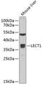 Chondromodulin antibody, 22-375, ProSci, Western Blot image 