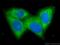 Ectonucleoside Triphosphate Diphosphohydrolase 1 antibody, 14211-1-AP, Proteintech Group, Immunofluorescence image 