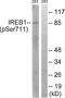 IRP1 antibody, P30450, Boster Biological Technology, Western Blot image 