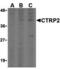 C1q And TNF Related 2 antibody, A16305, Boster Biological Technology, Western Blot image 