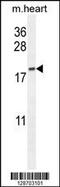 Outer Dense Fiber Of Sperm Tails 3B antibody, 55-439, ProSci, Western Blot image 