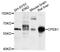 Cytoplasmic Polyadenylation Element Binding Protein 1 antibody, STJ27709, St John