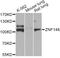 Zinc Finger Protein 148 antibody, STJ29081, St John