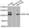 Zinc finger protein 148 antibody, STJ29081, St John