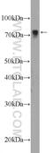 LIM domain kinase 2 antibody, 12350-1-AP, Proteintech Group, Western Blot image 