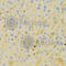 Pericentriolar Material 1 antibody, A5696, ABclonal Technology, Immunohistochemistry paraffin image 
