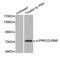 Protein Kinase C Theta antibody, STJ22344, St John