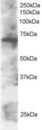 Switching B Cell Complex Subunit SWAP70 antibody, EB05384, Everest Biotech, Western Blot image 