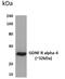 GDNF Family Receptor Alpha 4 antibody, GTX52764, GeneTex, Western Blot image 