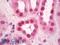 SWI/SNF Related, Matrix Associated, Actin Dependent Regulator Of Chromatin, Subfamily A, Member 4 antibody, LS-B8447, Lifespan Biosciences, Immunohistochemistry frozen image 