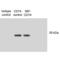 CD74 Molecule antibody, M01340, Boster Biological Technology, Western Blot image 