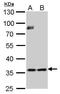 Thymidylate Synthetase antibody, PA5-27867, Invitrogen Antibodies, Western Blot image 