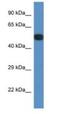 Serine/threonine-protein phosphatase 2A 56 kDa regulatory subunit epsilon isoform antibody, NBP1-74173, Novus Biologicals, Western Blot image 