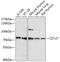 Interleukin 7 Receptor antibody, 14-353, ProSci, Western Blot image 