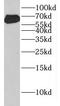 Frizzled Class Receptor 5 antibody, FNab03264, FineTest, Western Blot image 