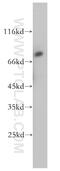 Metastasis Associated 1 Family Member 2 antibody, 17554-1-AP, Proteintech Group, Western Blot image 