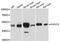 Q9Y2G5-1 antibody, A12223, ABclonal Technology, Western Blot image 