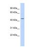 Keratin, type I cytoskeletal 24 antibody, NBP1-55188, Novus Biologicals, Western Blot image 