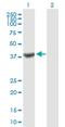 TruB Pseudouridine Synthase Family Member 1 antibody, H00142940-B01P, Novus Biologicals, Western Blot image 