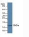 Galectin 7B antibody, LS-C302350, Lifespan Biosciences, Western Blot image 