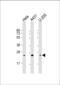 RAB1B, Member RAS Oncogene Family antibody, MA5-24749, Invitrogen Antibodies, Western Blot image 