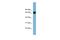 RIC8 Guanine Nucleotide Exchange Factor B antibody, A10110, Boster Biological Technology, Western Blot image 