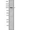 Centrobin, Centriole Duplication And Spindle Assembly Protein antibody, abx149439, Abbexa, Western Blot image 