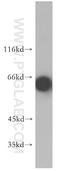Eukaryotic Translation Initiation Factor 2 Alpha Kinase 2 antibody, 18244-1-AP, Proteintech Group, Western Blot image 