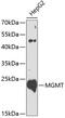 O-6-Methylguanine-DNA Methyltransferase antibody, 13-251, ProSci, Western Blot image 