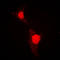 Forkhead Box O1 antibody, LS-C352214, Lifespan Biosciences, Immunofluorescence image 